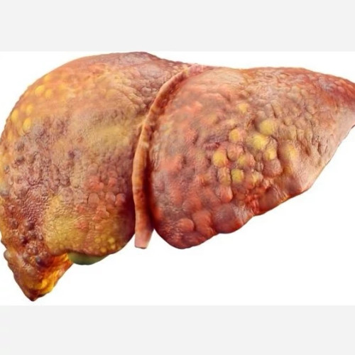 خرید آنلاین پک درمانی کبدچرب