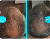 شامپو مورینگا اکسونیک اصل ۴ عددی