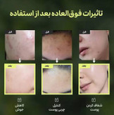 تونر پاک کننده صورت مخصوص پوست خشک و حساس